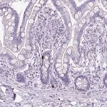 Merck Anti-GLP2R antibody produced in rabbit