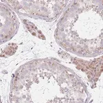 Merck Anti-SMPD4 antibody produced in rabbit