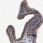 Merck Anti-MAP3K2 antibody produced in rabbit