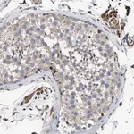 Merck Anti-SQLE antibody produced in rabbit