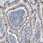 Merck Anti-AOAH antibody produced in rabbit