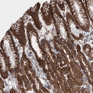 Merck Anti-KLHL26 antibody produced in rabbit