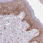 Merck Anti-CIZ1 antibody produced in rabbit