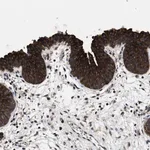 Merck Anti-PHLPP1 antibody produced in rabbit