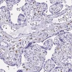 Merck Anti-ZNF850 antibody produced in rabbit
