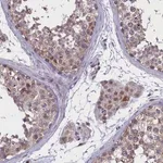 Merck Anti-PARS2 antibody produced in rabbit