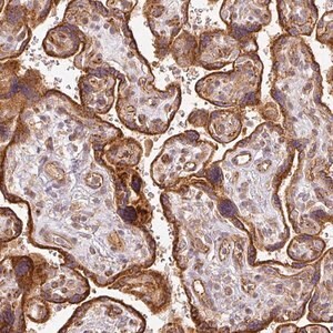 Merck Anti-CNOT1 antibody produced in rabbit