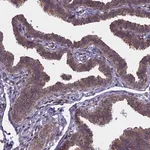 Merck Anti-NAA10 antibody produced in rabbit