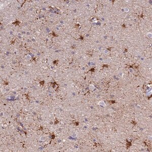 Merck Anti-PFKFB2 antibody produced in rabbit