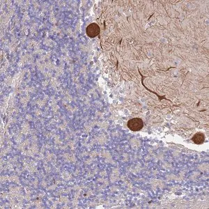 Merck Anti-CYLD antibody produced in rabbit