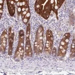 Merck Anti-SULT1A2 antibody produced in rabbit