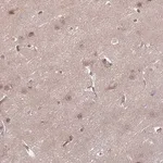 Merck Anti-DAAM2 antibody produced in rabbit