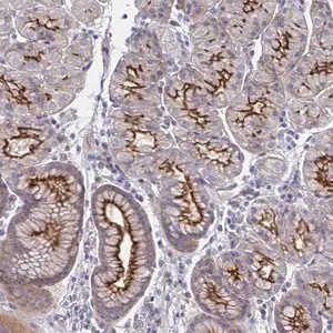 Merck Anti-SSTR1 antibody produced in rabbit