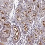 Merck Anti-SSTR1 antibody produced in rabbit