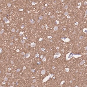 Merck Anti-ADD2 antibody produced in rabbit