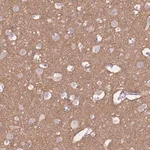 Merck Anti-ADD2 antibody produced in rabbit