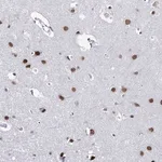 Merck Anti-ZC3H8 antibody produced in rabbit