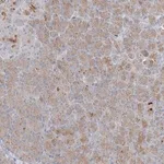 Merck Anti-C21orf58 antibody produced in rabbit