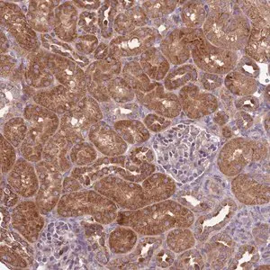 Merck Anti-IGF2BP2 antibody produced in rabbit
