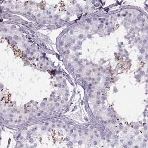 Merck Anti-FAM24B antibody produced in rabbit