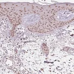 Merck Anti-THOC6 antibody produced in rabbit