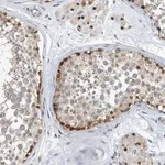 Merck Anti-KIF15 antibody produced in rabbit