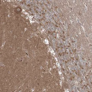 Merck Anti-C5orf42 antibody produced in rabbit