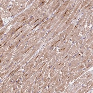 Merck Anti-TRIM55 antibody produced in rabbit