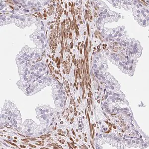 Merck Anti-KCNN4 antibody produced in rabbit