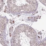 Merck Anti-ZSCAN9 antibody produced in rabbit