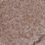 Merck Anti-RPUSD3 antibody produced in rabbit
