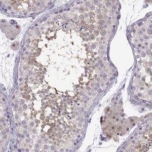 Merck Anti-CFAP70 antibody produced in rabbit