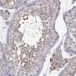 Merck Anti-CFAP70 antibody produced in rabbit