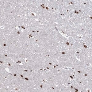 Merck Anti-ABHD10 antibody produced in rabbit