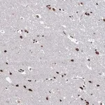Merck Anti-ABHD10 antibody produced in rabbit