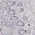 Merck Anti-NEU4 antibody produced in rabbit