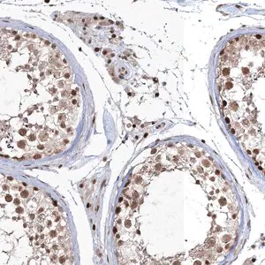 Merck Anti-QRICH1 antibody produced in rabbit