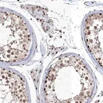 Merck Anti-QRICH1 antibody produced in rabbit