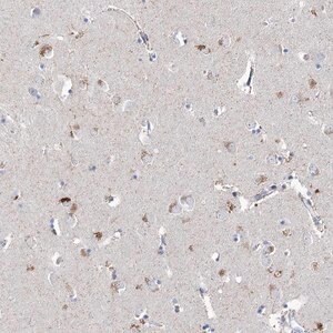 Merck Anti-LRRC14B antibody produced in rabbit