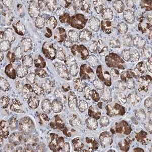 Merck Anti-TRIM71 antibody produced in rabbit