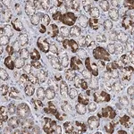 Merck Anti-TRIM71 antibody produced in rabbit