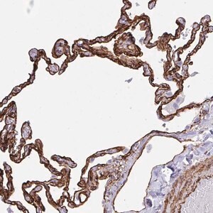 Merck Anti-IGSF23 antibody produced in rabbit
