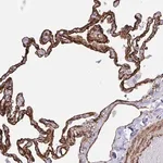 Merck Anti-IGSF23 antibody produced in rabbit