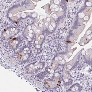 Merck Anti-FBXL22 antibody produced in rabbit