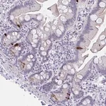 Merck Anti-FBXL22 antibody produced in rabbit