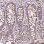Merck Anti-BRINP3 antibody produced in rabbit