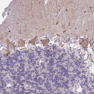 Merck Anti-KCNMA1 antibody produced in rabbit