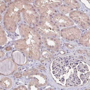 Merck Anti-RABGAP1L antibody produced in rabbit
