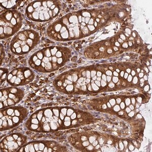 Merck Anti-PPP6R3 antibody produced in rabbit