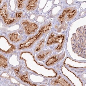 Merck Anti-ALDH3B1 antibody produced in rabbit